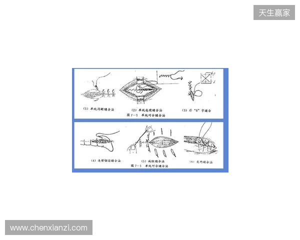 广州豹官方:杨浩眉弓伤口缝合30余针,预计5-7天后拆线